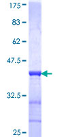 ab161002 on a 12.5% SDS-PAGE stained with Coomassie Blue.