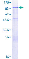 ab163865 on a 12.5% SDS-PAGE stained with Coomassie Blue.