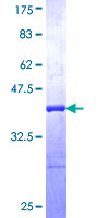 ab163866 on a 12.5% SDS-PAGE stained with Coomassie Blue.