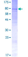 ab162666 on a 12.5% SDS-PAGE stained with Coomassie Blue.