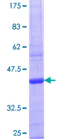 ab153417 on a 12.5% SDS-PAGE stained with Coomassie Blue.