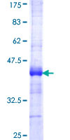 ab157828 on a 12.5% SDS-PAGE stained with Coomassie Blue.