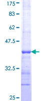 ab157831 on a 12.5% SDS-PAGE stained with Coomassie Blue.