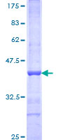 ab161338 on a 12.5% SDS-PAGE stained with Coomassie Blue.