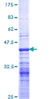 ab153201 on a 12.5% SDS-PAGE stained with Coomassie Blue.