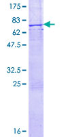 ab160862 on a 12.5% SDS-PAGE stained with Coomassie Blue.