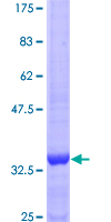 ab160863 on a 12.5% SDS-PAGE stained with Coomassie Blue.