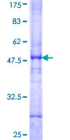 ab157833 on a 12.5% SDS-PAGE stained with Coomassie Blue.