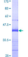 ab161875 on a 12.5% SDS-PAGE stained with Coomassie Blue.