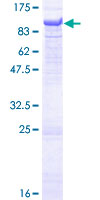 ab159985 on a 12.5% SDS-PAGE stained with Coomassie Blue.