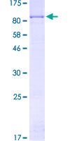 ab159987 on a 12.5% SDS-PAGE stained with Coomassie Blue.