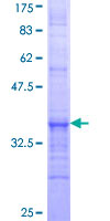 ab159988 on a 12.5% SDS-PAGE stained with Coomassie Blue.