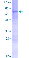 ab164946 on a 12.5% SDS-PAGE stained with Coomassie Blue.