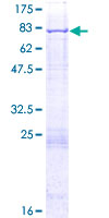 ab165845 on a 12.5% SDS-PAGE stained with Coomassie Blue.