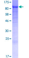 ab162640 on a 12.5% SDS-PAGE stained with Coomassie Blue.