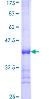 ab162641 on a 12.5% SDS-PAGE stained with Coomassie Blue.