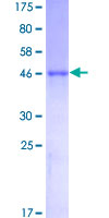 ab160496 on a 12.5% SDS-PAGE stained with Coomassie Blue.