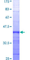 ab157840 on a 12.5% SDS-PAGE stained with Coomassie Blue.