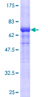 ab157842 on a 12.5% SDS-PAGE stained with Coomassie Blue.