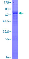 ab157843 on a 12.5% SDS-PAGE stained with Coomassie Blue.