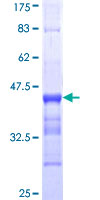 ab157844 on a 12.5% SDS-PAGE stained with Coomassie Blue.