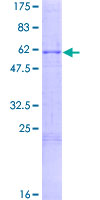 ab159158 on a 12.5% SDS-PAGE stained with Coomassie Blue.