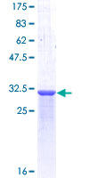 ab159159 on a 12.5% SDS-PAGE stained with Coomassie Blue.