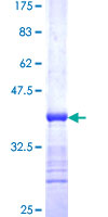 ab157846 on a 12.5% SDS-PAGE stained with Coomassie Blue.