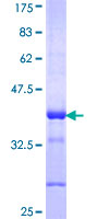 ab157845 on a 12.5% SDS-PAGE stained with Coomassie Blue.