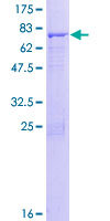 ab161186 on a 12.5% SDS-PAGE stained with Coomassie Blue.