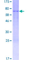 ab163516 on a 12.5% SDS-PAGE stained with Coomassie Blue.