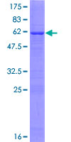 ab160759 on a 12.5% SDS-PAGE stained with Coomassie Blue.