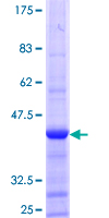 ab160760 on a 12.5% SDS-PAGE stained with Coomassie Blue.