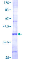 ab157893 on a 12.5% SDS-PAGE stained with Coomassie Blue.