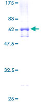 ab159622 on a 12.5% SDS-PAGE stained with Coomassie Blue.