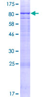 ab165739 on a 12.5% SDS-PAGE stained with Coomassie Blue.