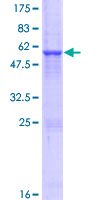 ab165735 on a 12.5% SDS-PAGE stained with Coomassie Blue.