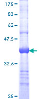ab158869 on a 12.5% SDS-PAGE stained with Coomassie Blue.