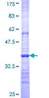 ab160171 on a 12.5% SDS-PAGE stained with Coomassie Blue.