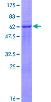ab153364 on a 12.5% SDS-PAGE stained with Coomassie Blue.