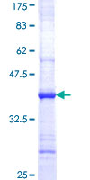 ab161289 on a 12.5% SDS-PAGE stained with Coomassie Blue.