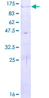 ab165898 on a 12.5% SDS-PAGE stained with Coomassie Blue.