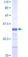 ab153525 on a 12.5% SDS-PAGE stained with Coomassie Blue.