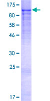 ab160174 on a 12.5% SDS-PAGE stained with Coomassie Blue.