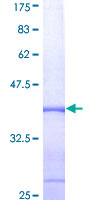 ab160173 on a 12.5% SDS-PAGE stained with Coomassie Blue.