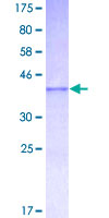 ab152994 on a 12.5% SDS-PAGE stained with Coomassie Blue.