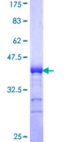 ab153619 on a 12.5% SDS-PAGE stained with Coomassie Blue.
