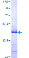 ab152993 on a 12.5% SDS-PAGE stained with Coomassie Blue.