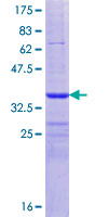 ab153157 on a 12.5% SDS-PAGE stained with Coomassie Blue.