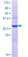 ab161336 on a 12.5% SDS-PAGE stained with Coomassie Blue.